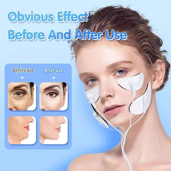 High Quality EMS Facial Lifting Massager, Muscle Stimulator Face Beauty Device, Skin Tightening & Anti-Wrinkle Machine, Dark 