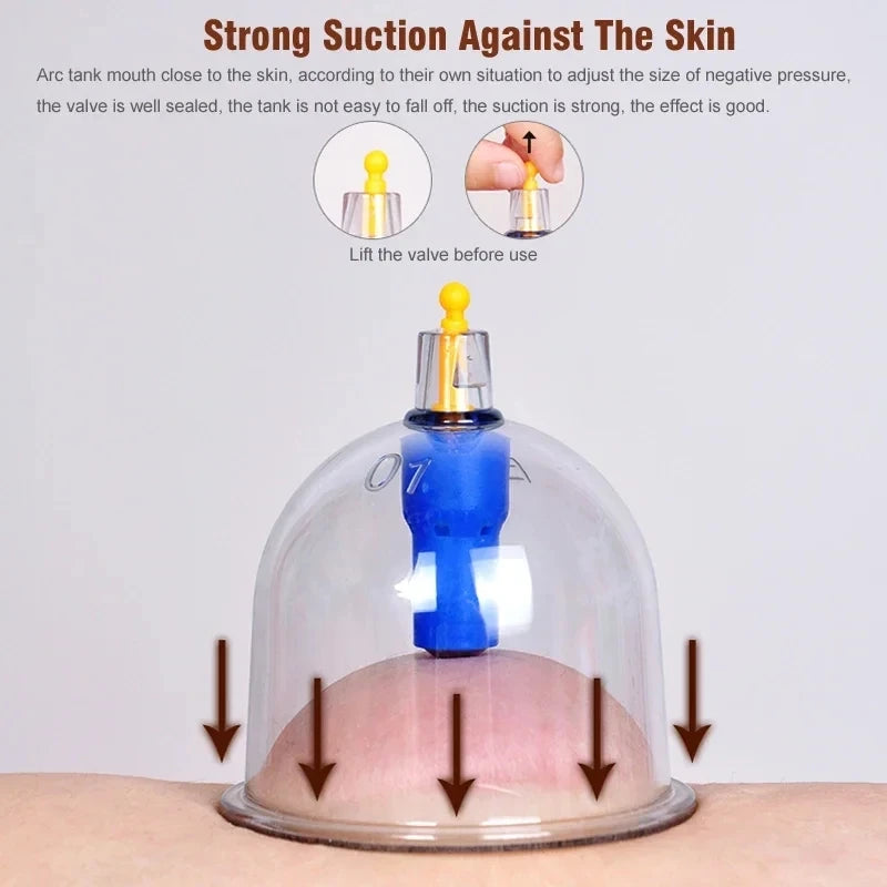 Premium Cupping Therapy Set – Professional Vacuum Suction Cups for Chinese Medicine Physiotherapy, Massage, and Muscle Relaxation, Durable Plastic Jars for Home and Professional Use