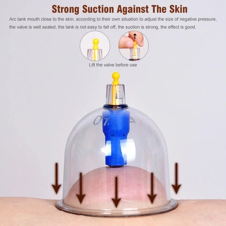 Premium Cupping Therapy Set – Professional Vacuum Suction Cups for Chinese Medicine Physiotherapy, Massage, and Muscle Relaxation, Durable Plastic Jars for Home and Professional Use