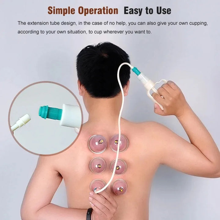 Premium Cupping Therapy Set – Professional Vacuum Suction Cups for Chinese Medicine Physiotherapy, Massage, and Muscle Relaxation, Durable Plastic Jars for Home and Professional Use